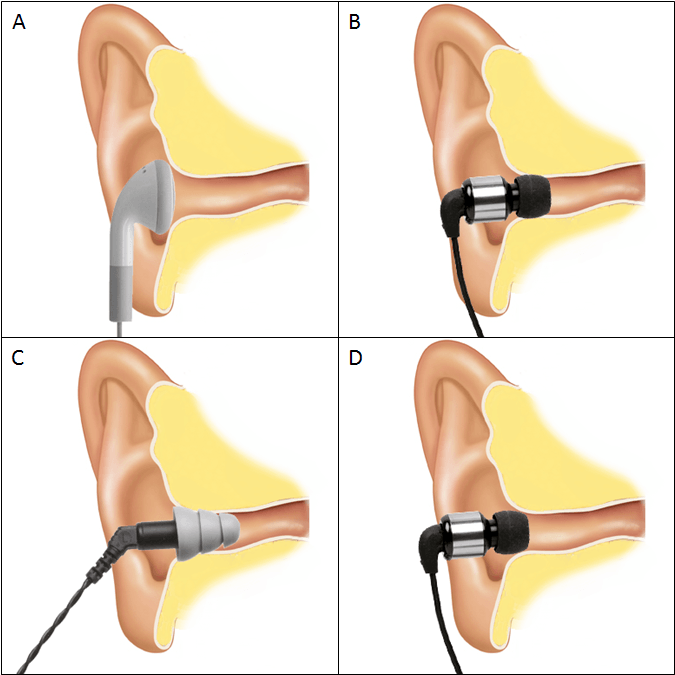 Auriculares in-ear: ¿Cómo se ponen y qué ventajas tienen?