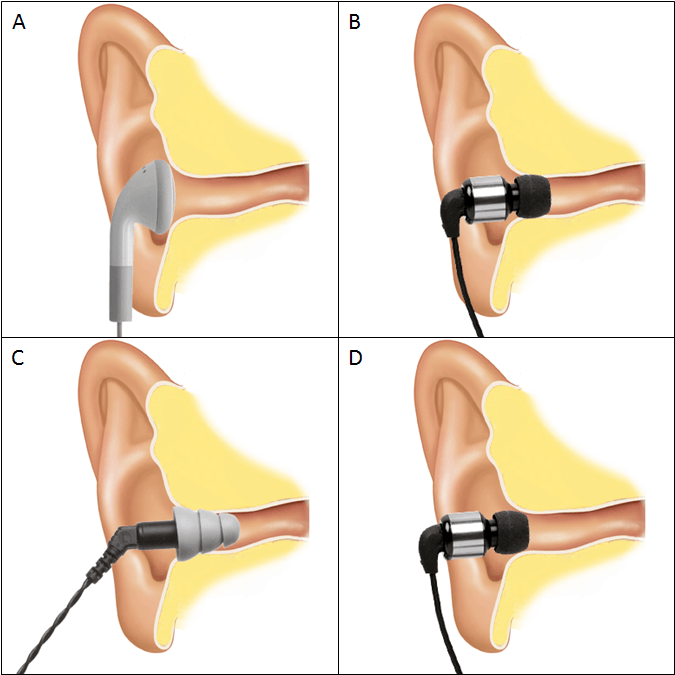 Cómo limpiar tus auriculares in-ear para dejarlos como nuevos